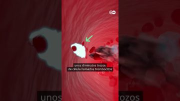[ID: zmwfK5_mDTo] Youtube Automatic